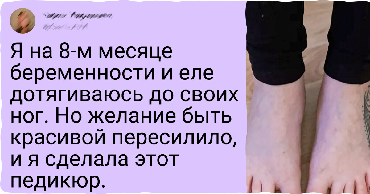 16 женщин, которые жизни не представляют без умопомрачительного педикюра