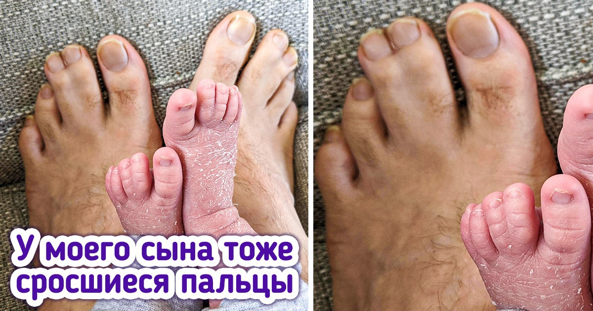 10+ человек, которые не стали исправлять свои особенности, посчитав их уникальными