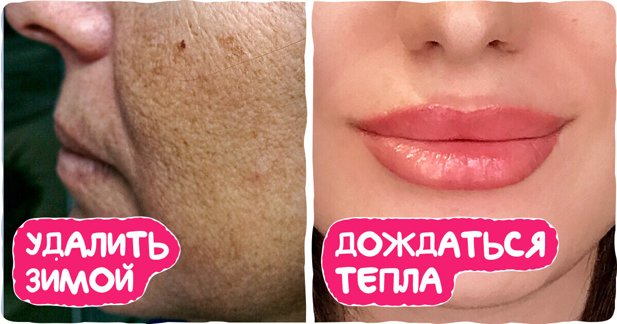 Мы разобрались, какие процедуры идеальны для зимы, а от каких не будет ни грамма пользы Мы разобрались, какие процедуры идеальны для зимы, а от каких не будет ни грамма пользы