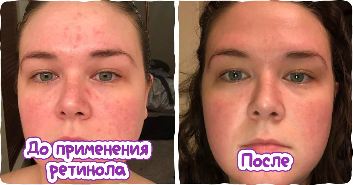 Химик раскрыла секреты 12 косметических средств, и мы взяли на заметку все до одного Химик раскрыла секреты 12 косметических средств, и мы взяли на заметку все до одного