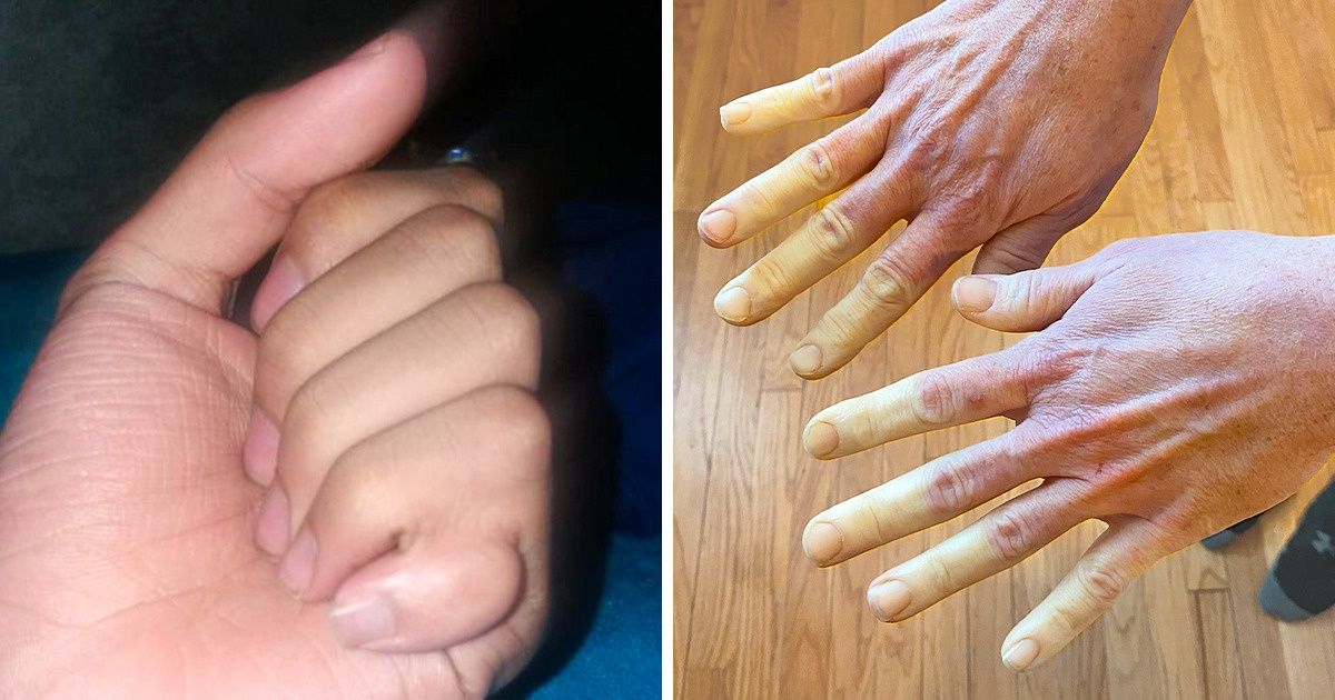 15 человек, которых природа одарила поистине экстраординарными чертами