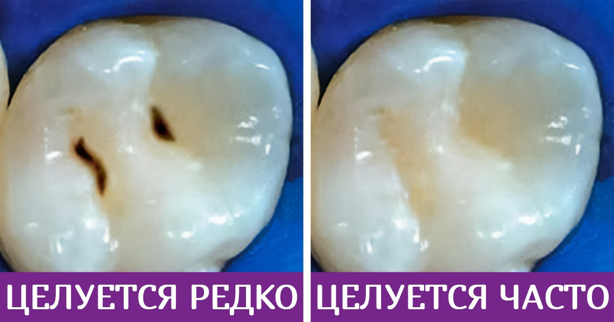 Что происходит с вашим телом, когда вы часто целуетесь