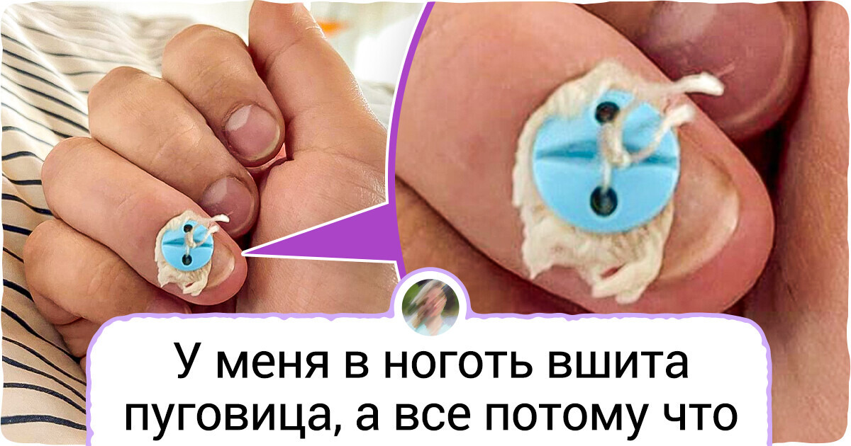 20 человек, с которыми произошли такие события, что Вселенная сама в шоке