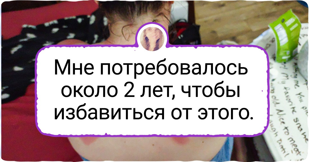 17 фотографий, глядя на которые переживаешь за автора, как за самого себя