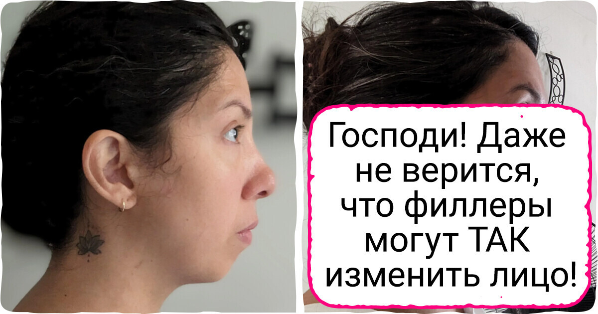 18 фото, которые наглядно показывают разницу между «до» и «после» 18 фото, которые наглядно показывают разницу между «до» и «после»