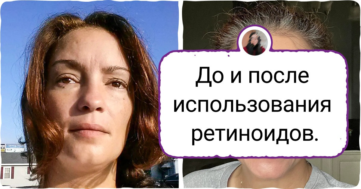 15+ сравнений, в которых можно разглядеть громадную разницу