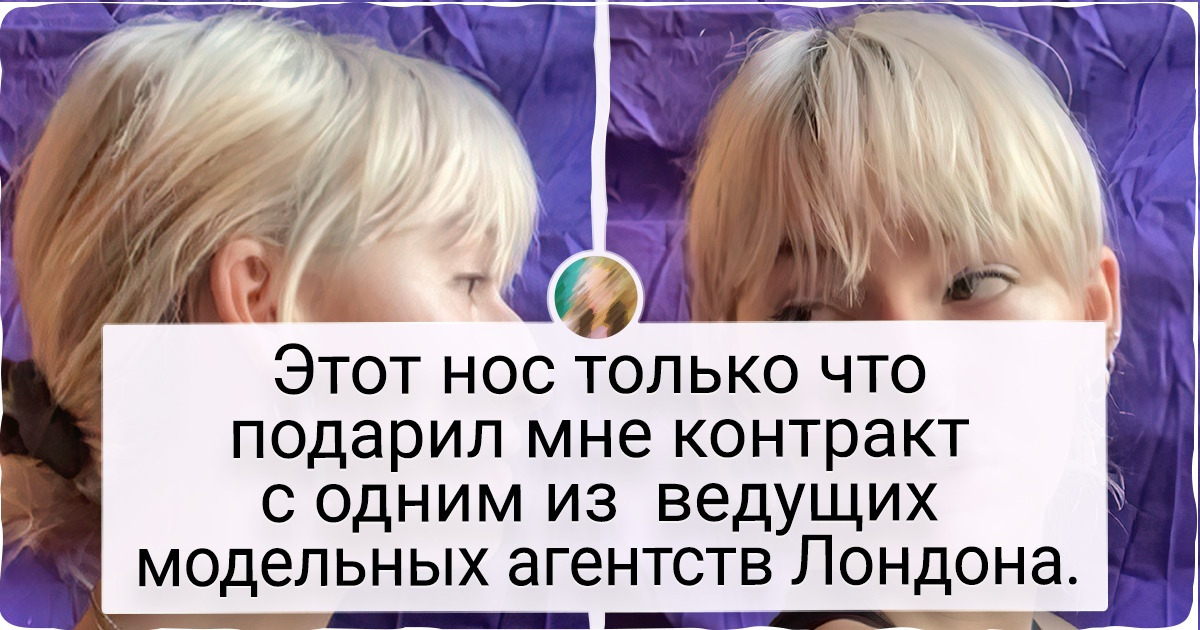 15+ девушек рассказали, как прошли все стадии от ненависти до любви к своим выдающимся носам 15+ девушек рассказали, как прошли все стадии от ненависти до любви к своим выдающимся носам