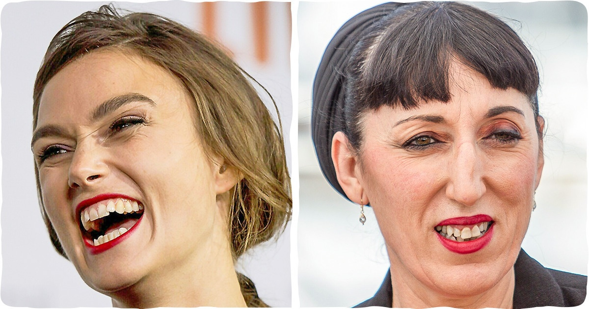 15 звезд, которые не стали париться из-за неидеальной улыбки и сделали ее своей изюминкой 15 звезд, которые не стали париться из-за неидеальной улыбки и сделали ее своей изюминкой