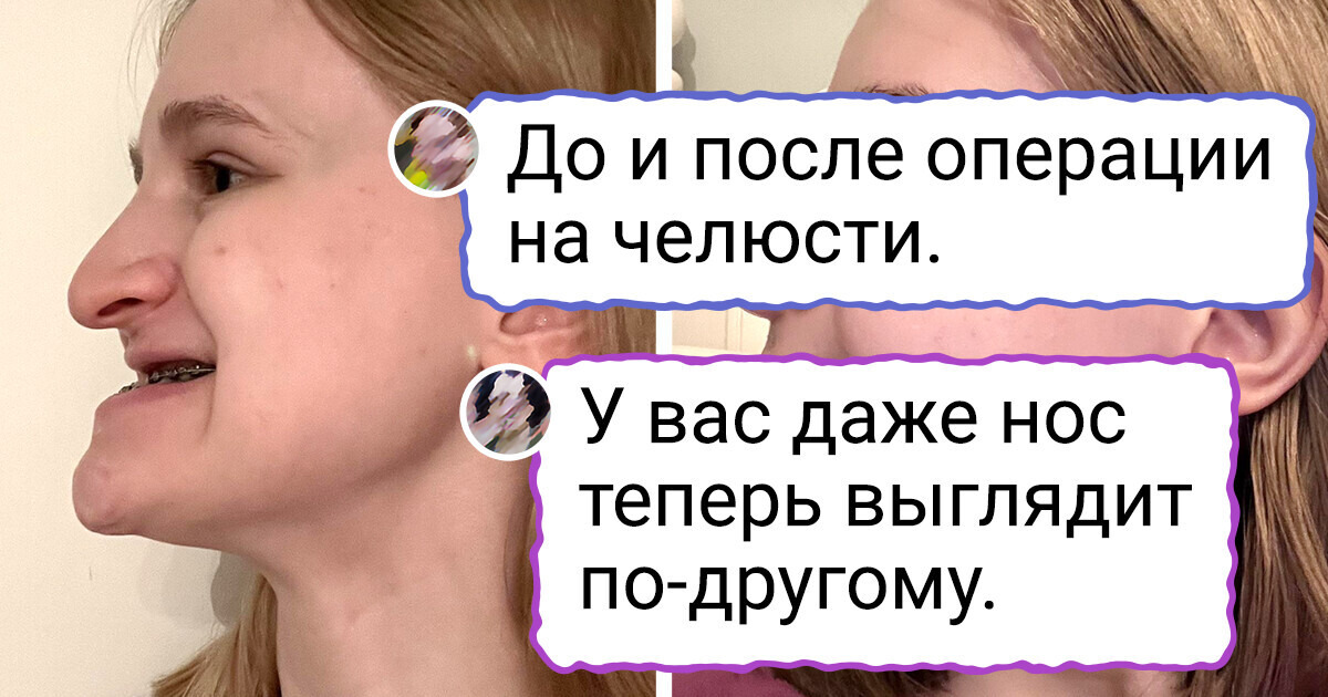 15+ человек изменили в себе одну деталь, и весь интернет дружно уронил челюсть, увидев результат