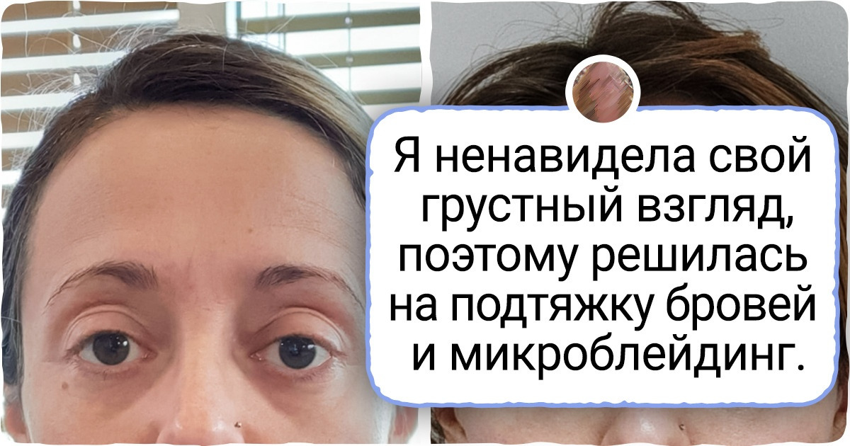 15 девушек доказали, что новые брови могут изменить внешность не хуже пластической операции