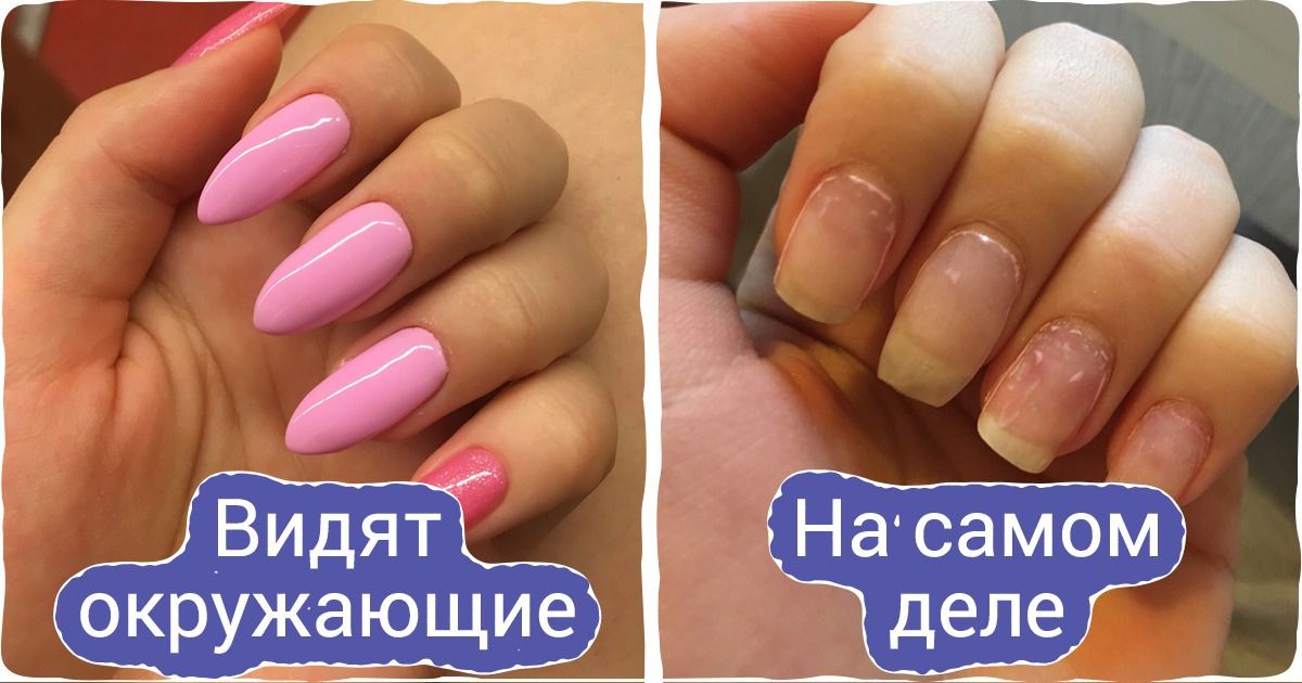 15 девушек честно рассказали, почему они отказались от модных бьюти-процедур