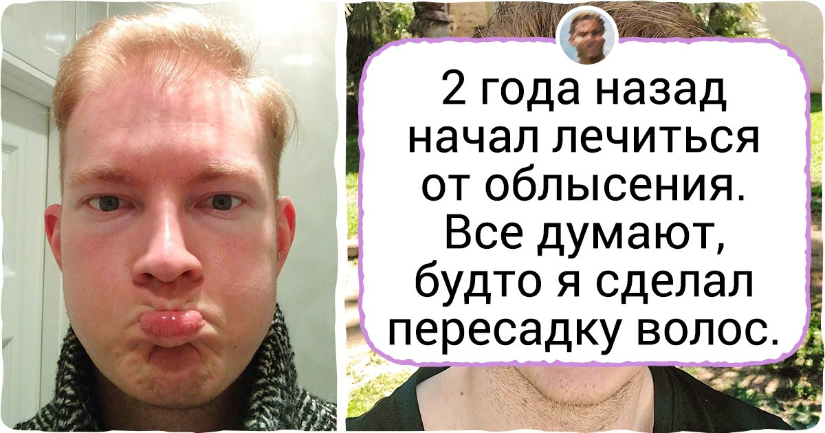16 мужчин, которые отбросили дурацкие предрассудки и всерьез занялись своей внешностью