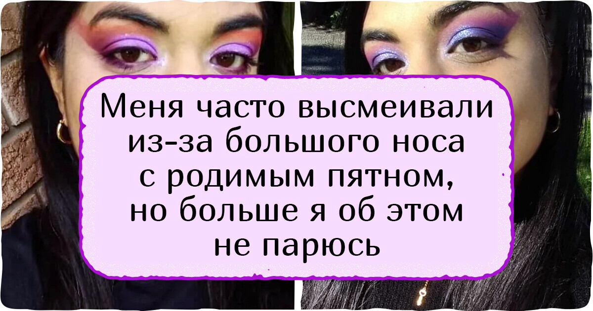 18 человек, которые долго мечтали что-то в себе изменить, а потом взяли и приняли себя со всеми изюминками