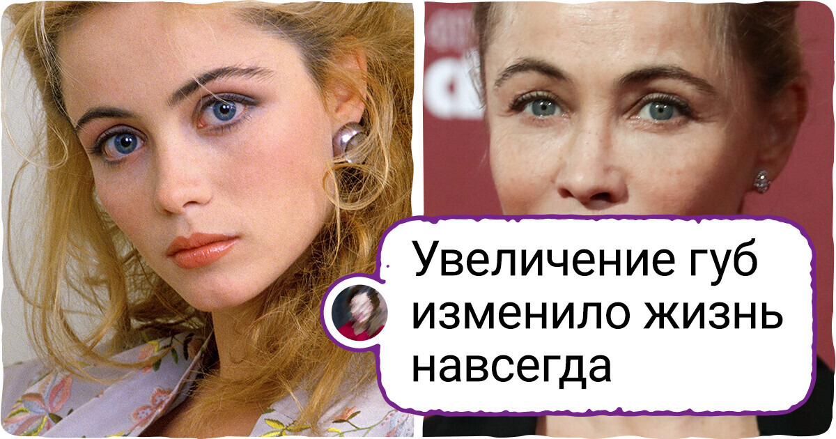 9 звезд, которые сделали бьюти-процедуры, но что-то пошло не по плану 9 звезд, которые сделали бьюти-процедуры, но что-то пошло не по плану