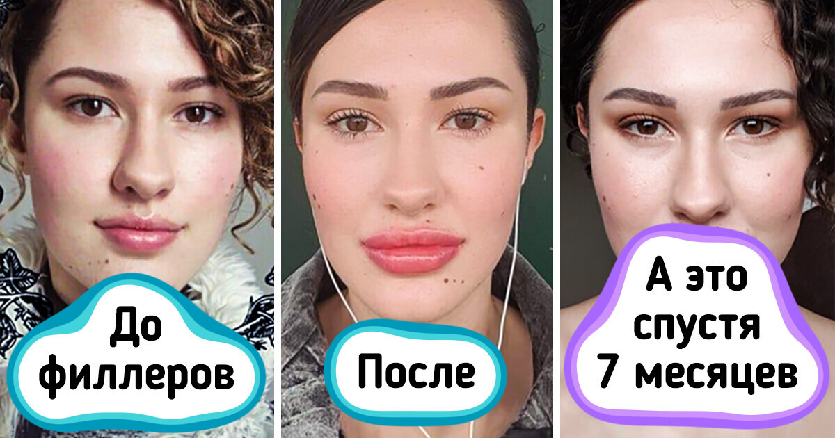 15 девушек решились на модные бьюти-процедуры, но потом долго утирали горькие слезы 15 девушек решились на модные бьюти-процедуры, но потом долго утирали горькие слезы