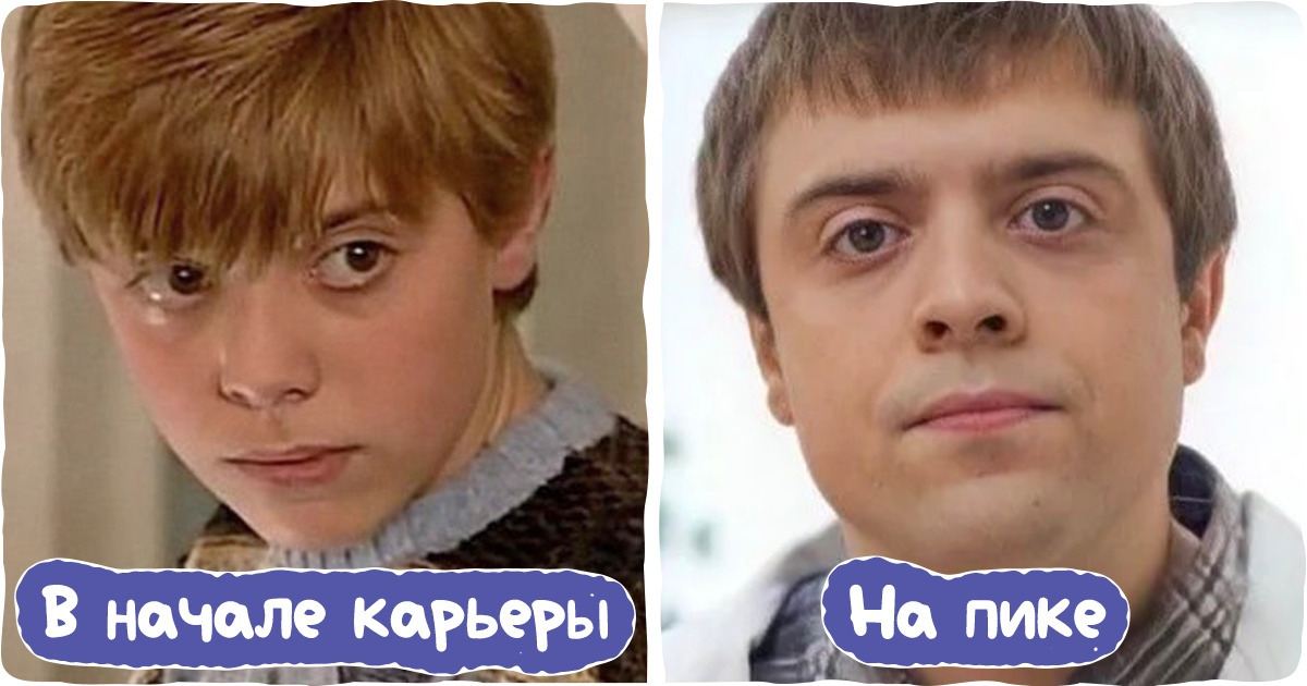Как выглядели 14 наших любимых звезд до того, как обзавелись толпами поклонников