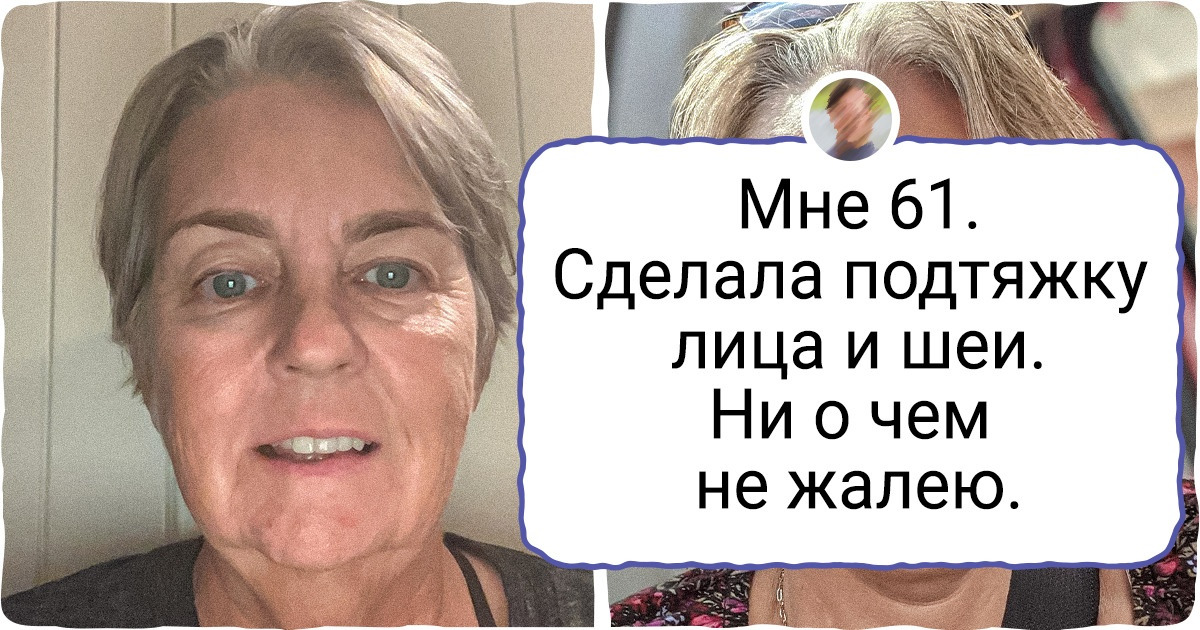 10+ женщин, которые сделали пластику и теперь смотрят в зеркало с улыбкой