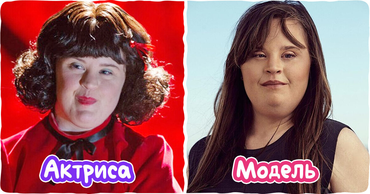 История Джейми Брюэр — первой женщины с синдромом Дауна, которая добилась мировой славы История Джейми Брюэр — первой женщины с синдромом Дауна, которая добилась мировой славы