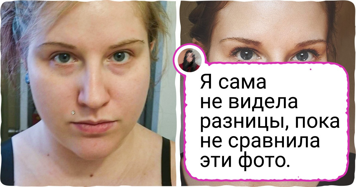 15+ пар фото, на которые глянешь — и сразу поймешь, что такое настоящее превращение