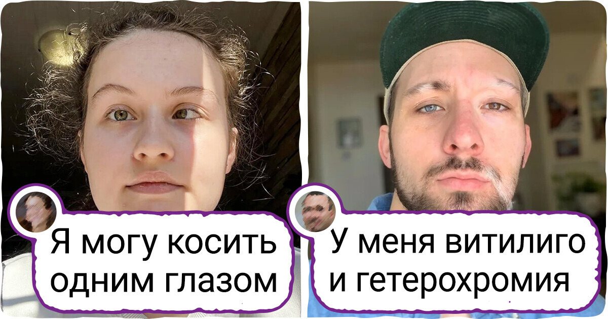 20+ человек, которых природа одарила такими фишечками, что хоть стой, хоть падай