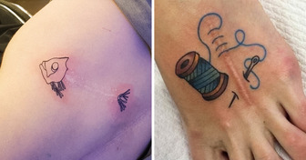 18 человек, которые искусно вписали свои шрамы и родимые пятна в татуировки