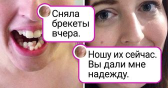 16 красавчиков, которые сняли брекеты и теперь любую голливудскую улыбку перещеголяют
