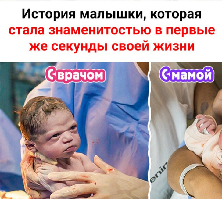 История малышки, которая стала знаменитостью в первые же секунды своей жизни